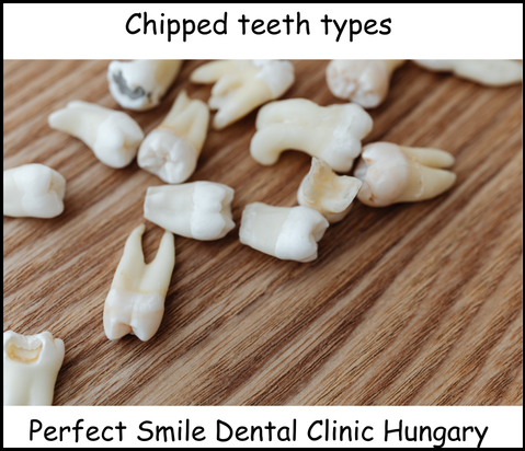 Chipped teeth types image