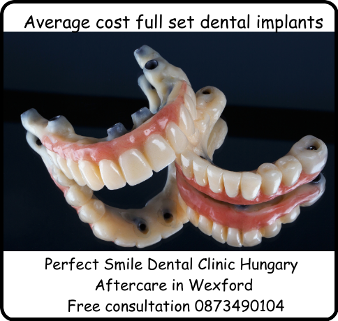 Average cost full set dental implants image
