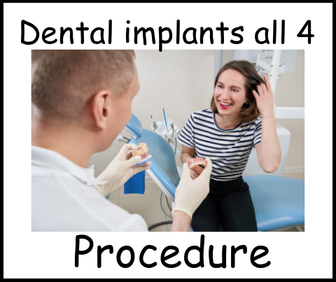 Dental implants all 4 procedure image