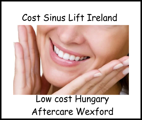 Cost sinus lift Ireland image