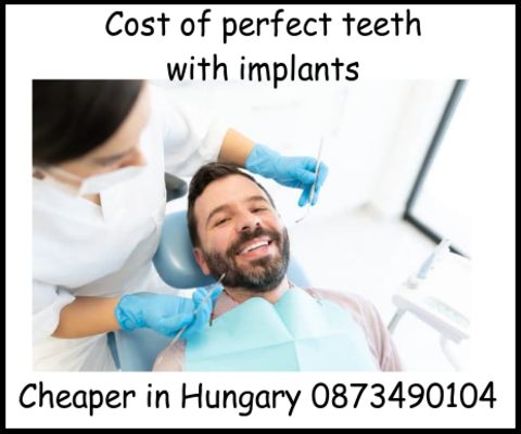 Cost of perfect teeth with implants image