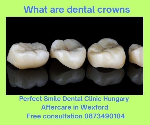 What are dental crowns image