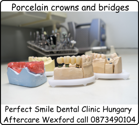 Porcelain crowns and bridges image