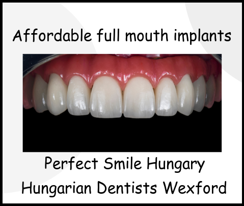 Affordable full mouth implant Perfect Smile Hungary image