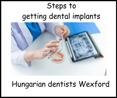 Steps to getting dental implants image