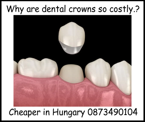 Why are dental crowns so costly image