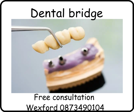 Dental bridge image