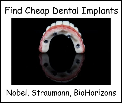 Find cheap dental implants image