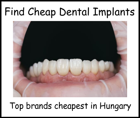 Find cheap dental implants top brands cheapest in Hungary image