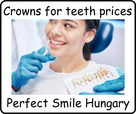 Crowns for teeth prices image