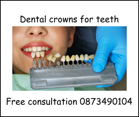 Dental crowns for teeth image