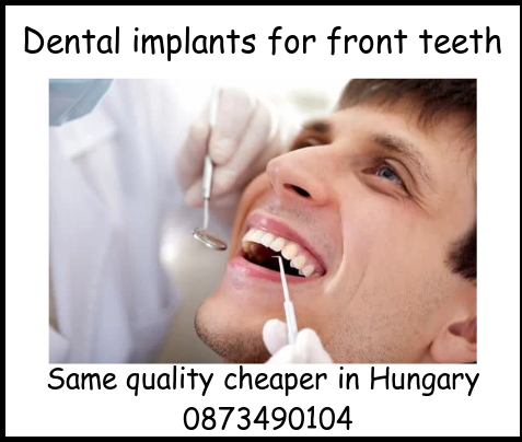 Dental implants for front teeth image 1