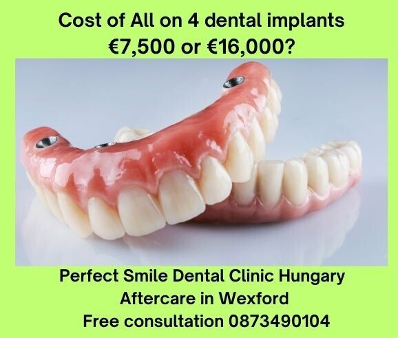 Cost of all on 4 dental implants image