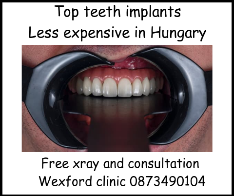 Top teeth implants image 1