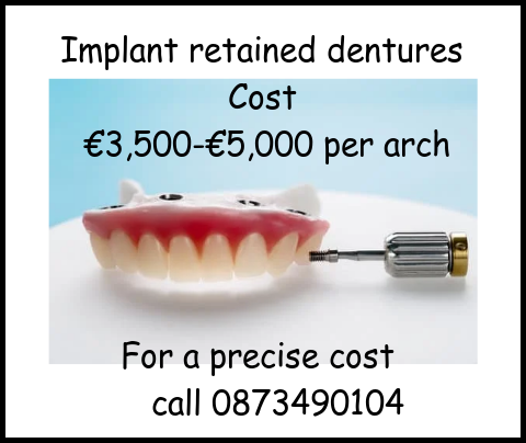 Implant retained dentures cost image