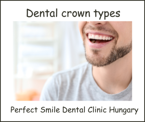 Dental crown types image