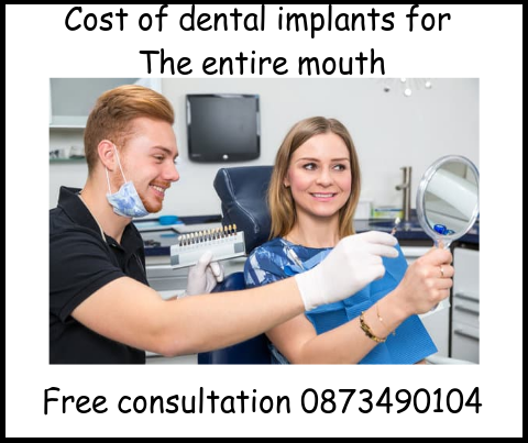 Cost of dental implants for the entire mouth free consultation image