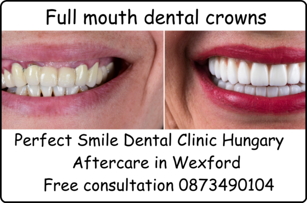 Full mouth dental crowns image 