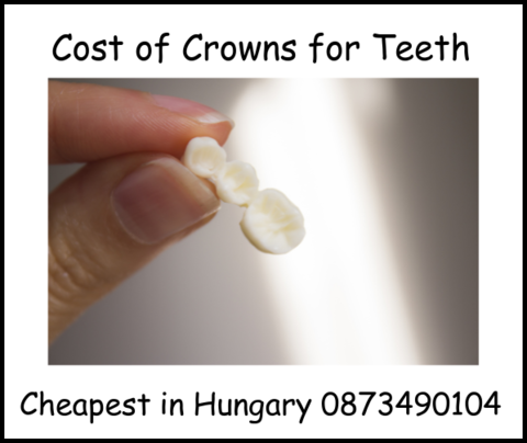 Cost of crowns for teeth image