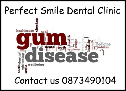 Gum disease Perfect Smile dental clinic image