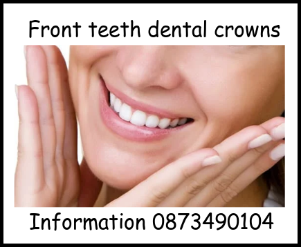 Front teeth dental crowns image