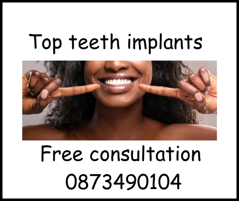 Top teeth implants image 2