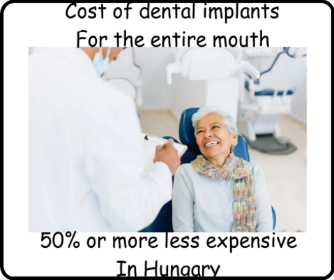 Cost of dental implants for the entire mouth in Hungary image