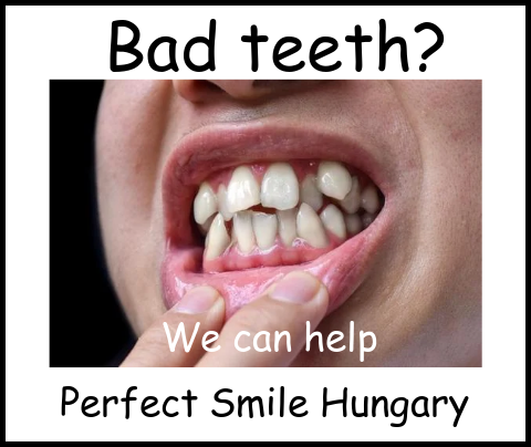 Bad teeth image