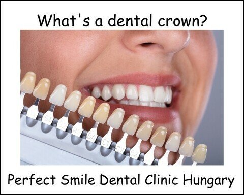 What's a dental crown image