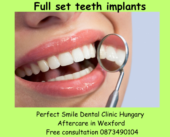 Full set teeth implants image