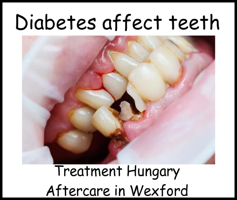 Diabetes affect teeth treatment Hugary image