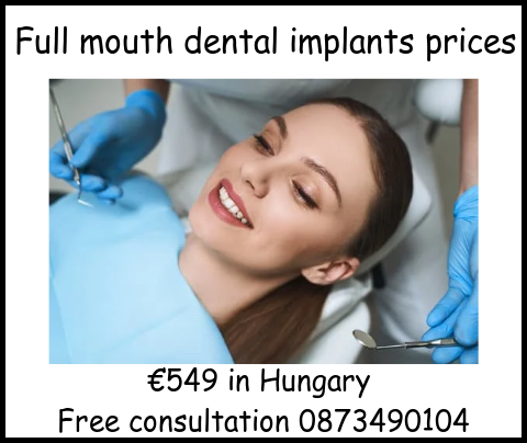 Full mouth dental implants prices image 2