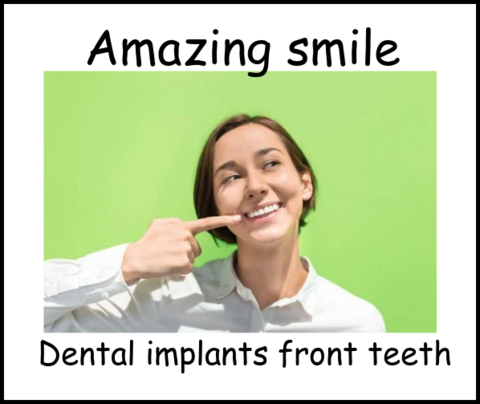 Amazing smile dental implants image