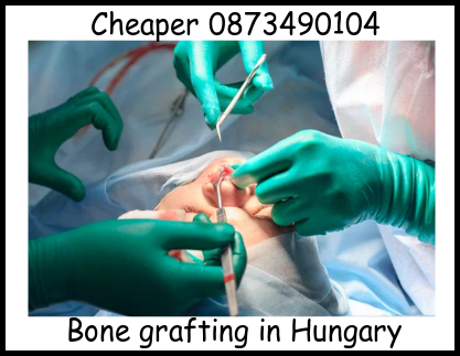 Bone grafting dental implants in Hungary image