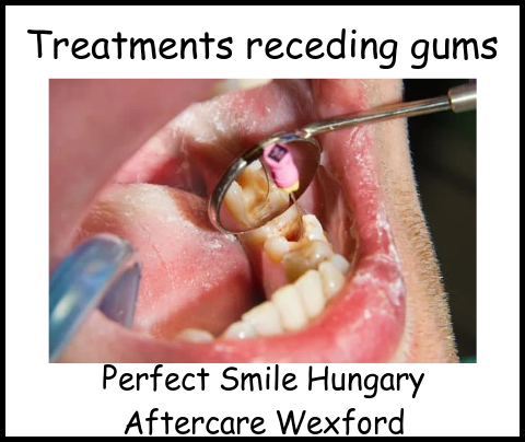 Treatments receding gums image