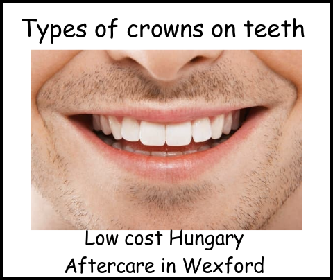 Types of crowns on teeth image