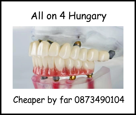 All on 4 Hungary image