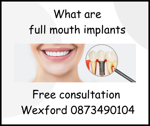 What are full mouth implants image