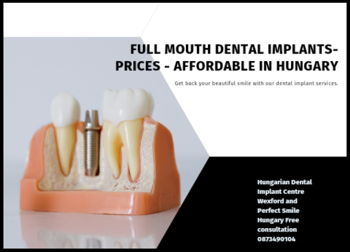 Full mouth dental implants prices 