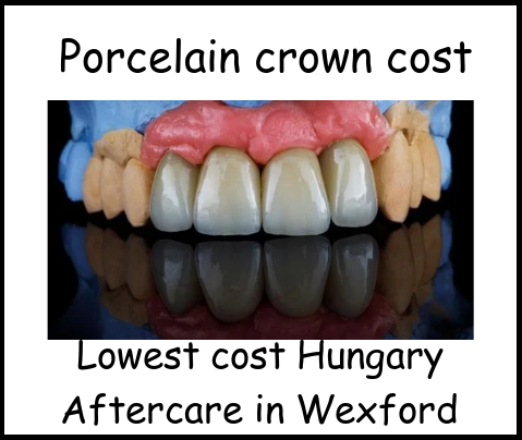 Porcelain crown cost image