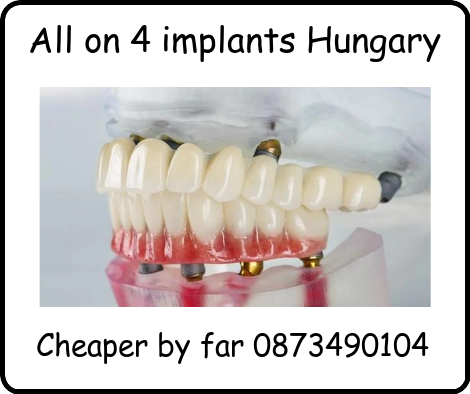 All on 4 implants Hungary image