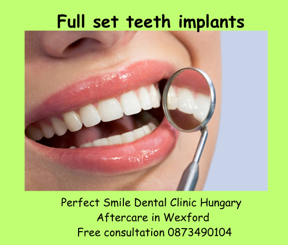 Full set teeth implants image