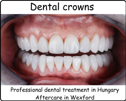 Dental crowns image