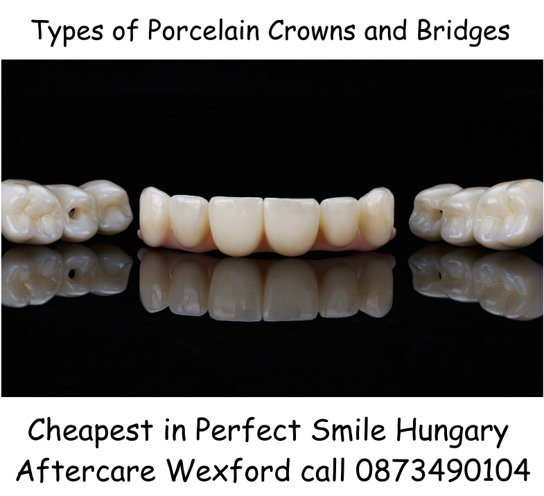 Types of crowns and bridges cheapest in Perfect Smile dental clinic Hungary image