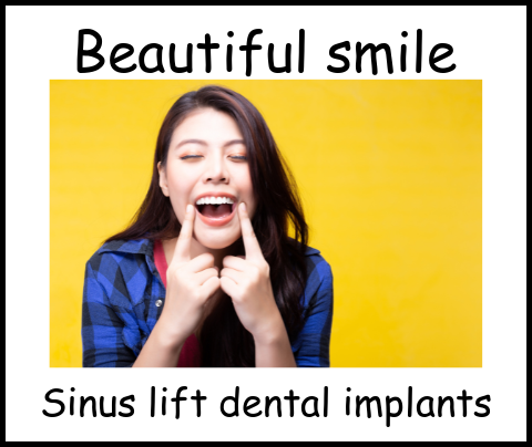 Sinus lift for dental implant image