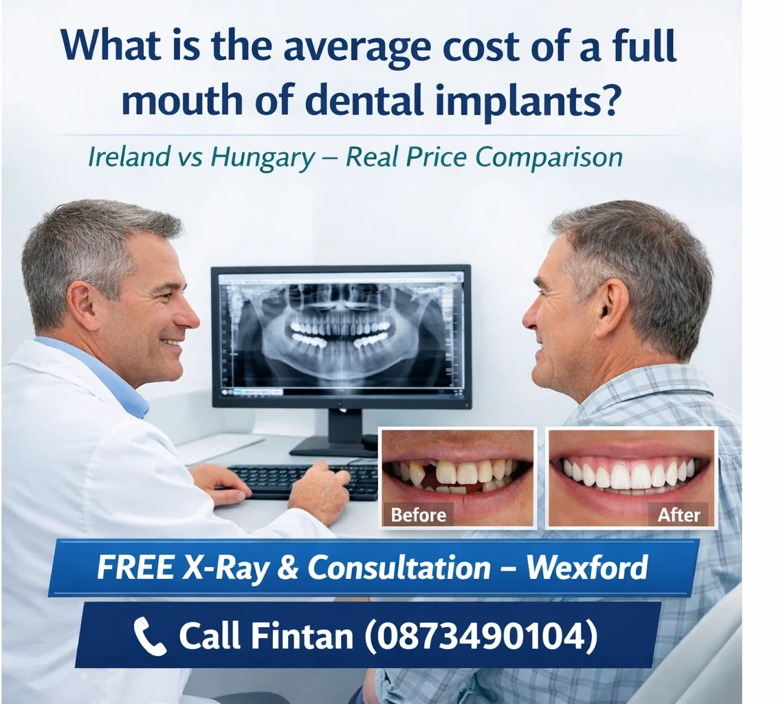 What is the average cost of a full mouth of dental implants image