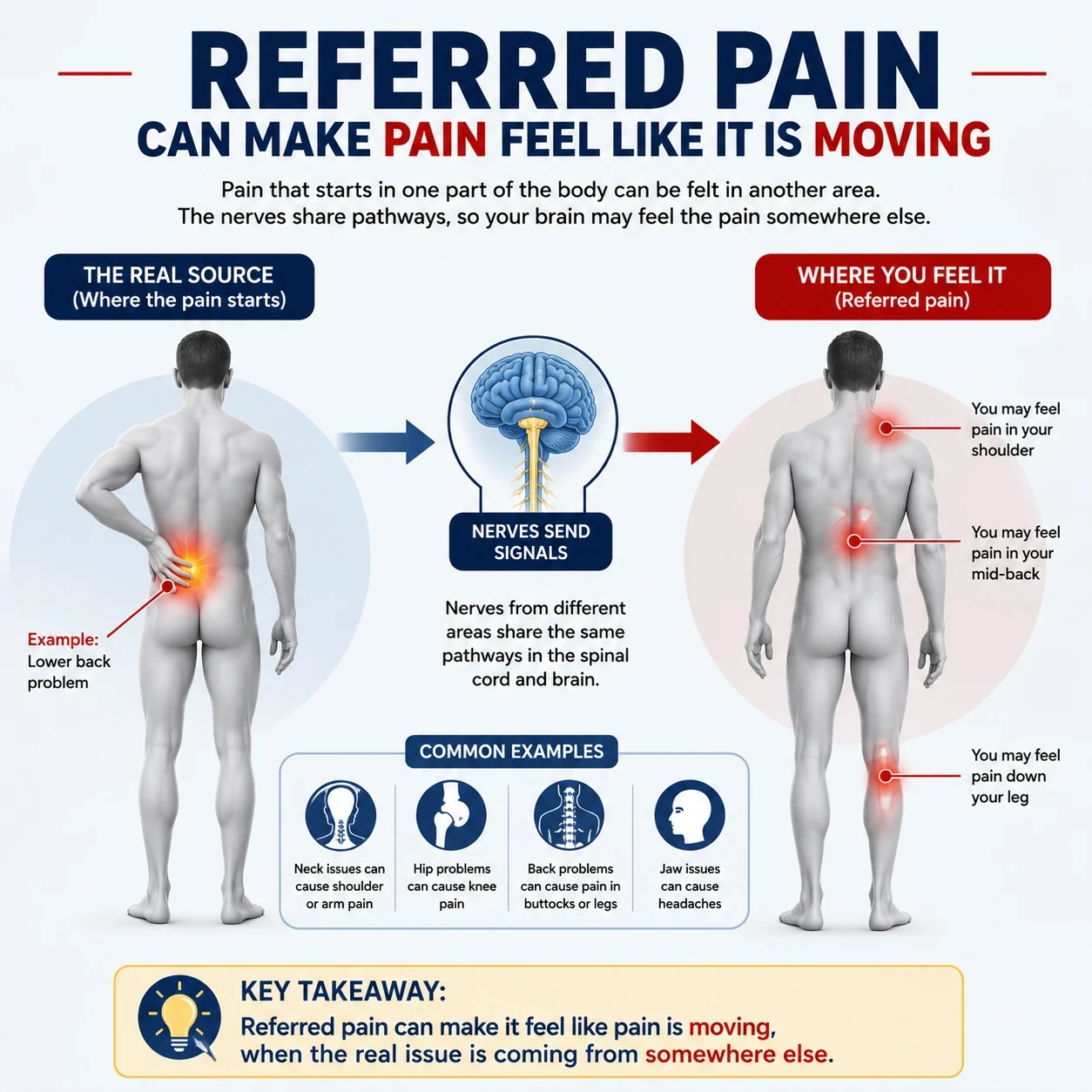 Referred pain can make it feel like it is moving image