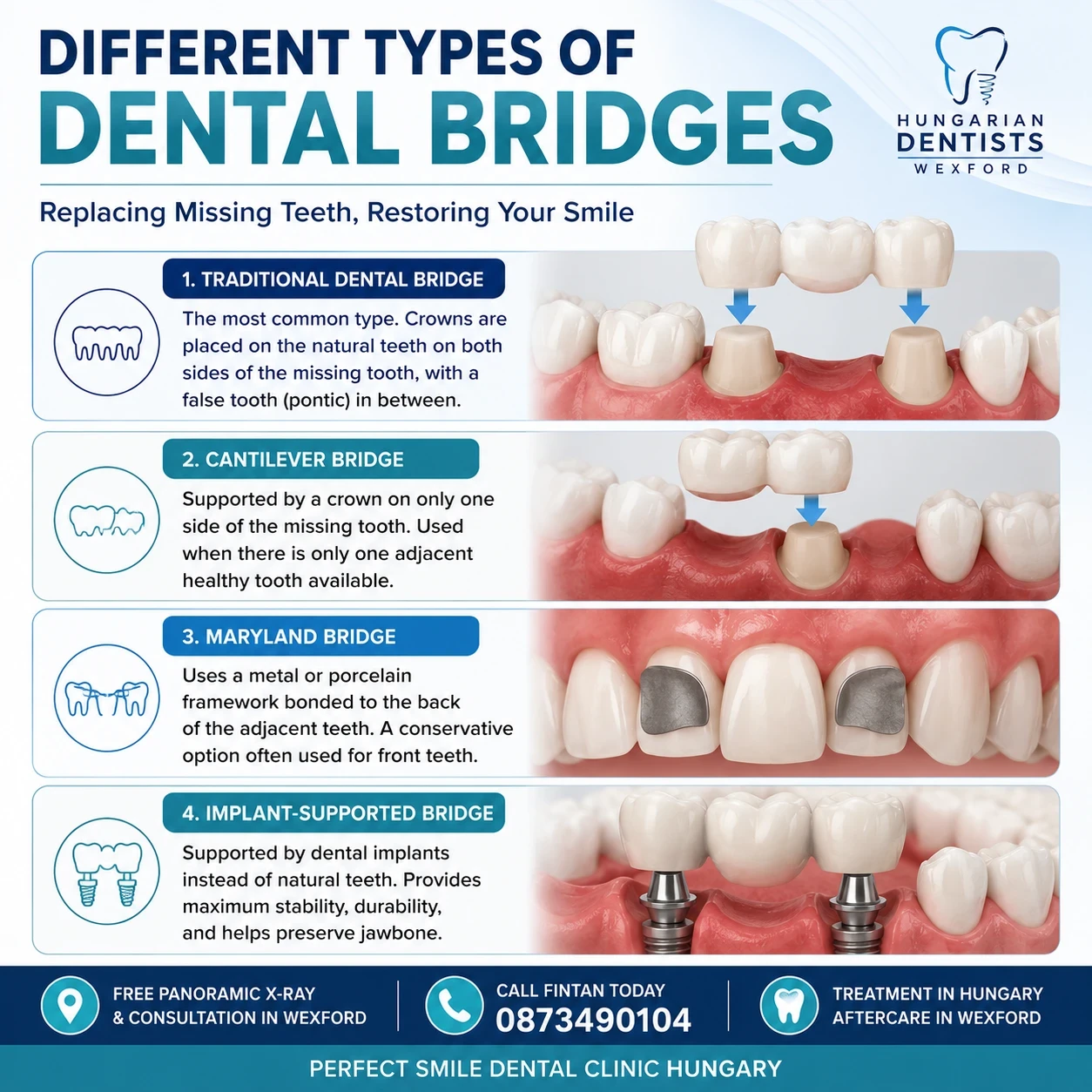 Different Types of Dental Bridges image