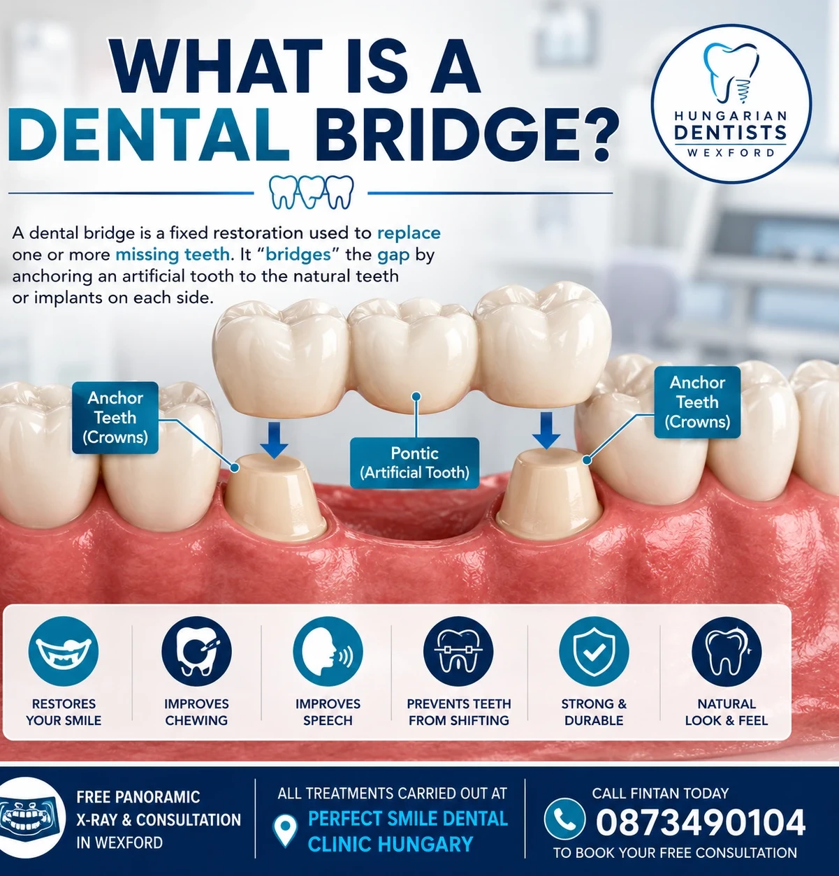 What Is a dental bridge image