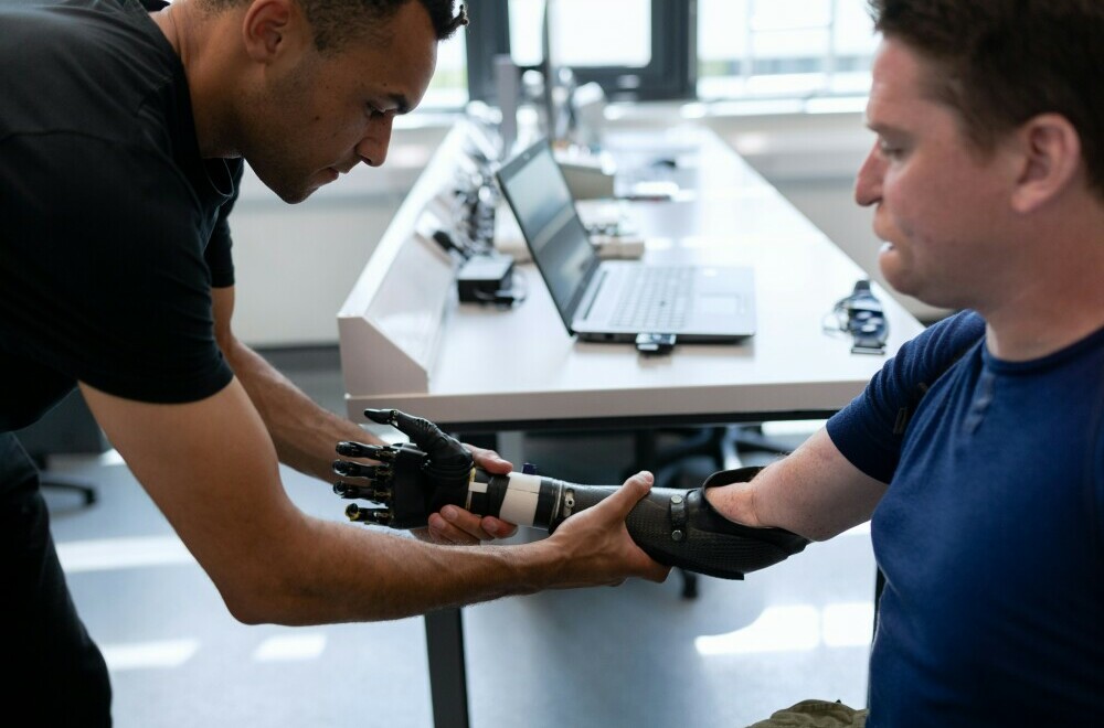 amputee receiving right arm prosthesis